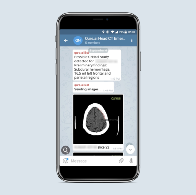 The Telegram integrated solution for radiologist's that Qure.ai has developed
